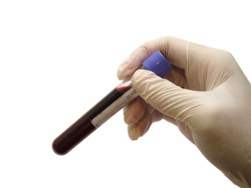 Тестирование анализа крови