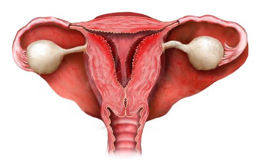 Эндометрит матки - основные симптомы и методы лечения