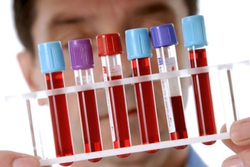 Методы лабораторной диагностики ВИЧ-инфекции